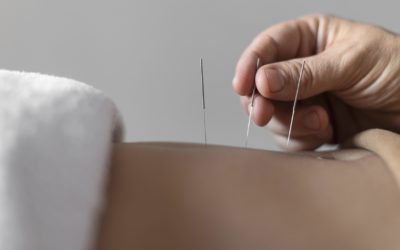 Benefits of Acupuncture For Stress and Anxiety